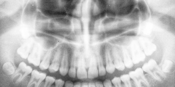 prima seguro dental