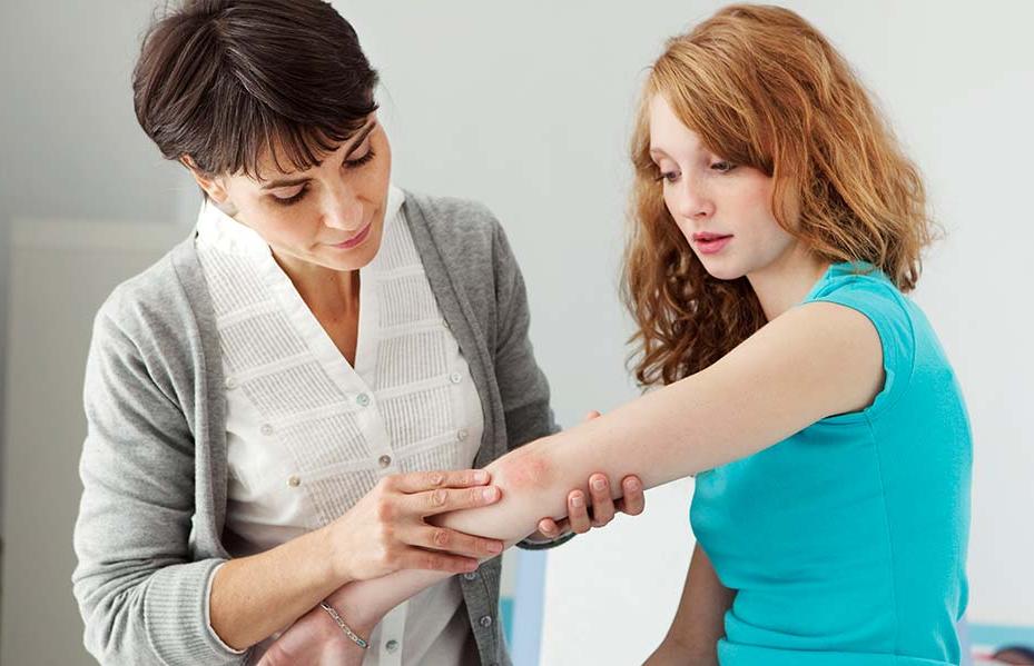 Psoriasis