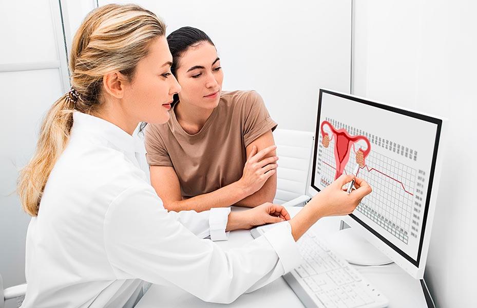 ovarios-poliquisticos