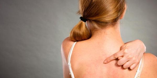 diferencia urticaria alergia