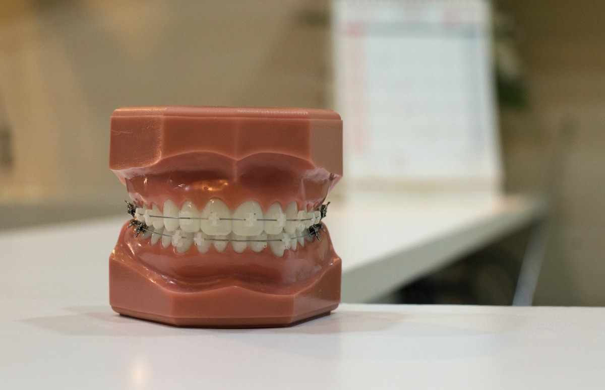 Coberturas de tu seguro dental
