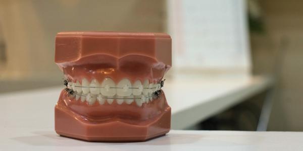 Coberturas de tu seguro dental