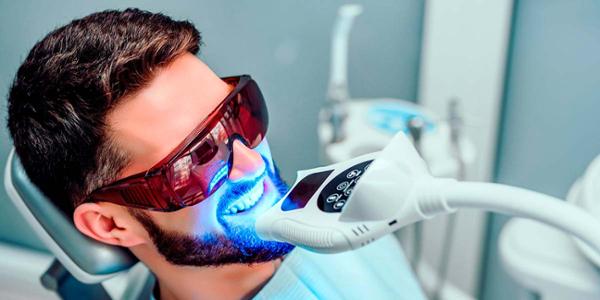 Descubre todos los tipos de blanqueamiento dental