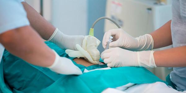 Prueba de la amniocentesis; qué es, cómo y cuándo se realiza